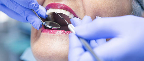 Best Emergency Dental Extractions in Palmview South, TX